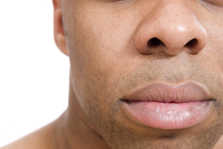 Debes bajar la inflamación de los labios, cualquiera sea la causa.