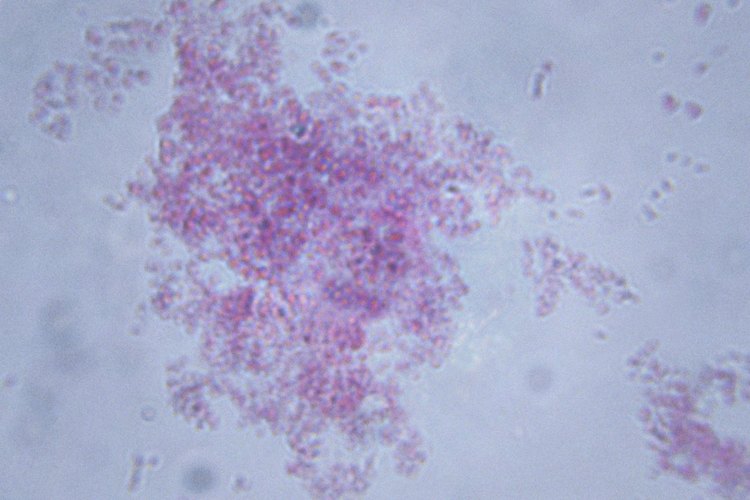 Maneras de eliminar las bacterias.