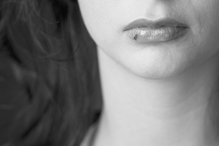 Existen formas de eliminar las cicatrices de los labios.