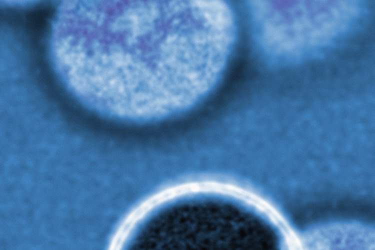 Los papilomas escamosos son tumores pequeños, no cancerígenos, que se originan en células escamosas.