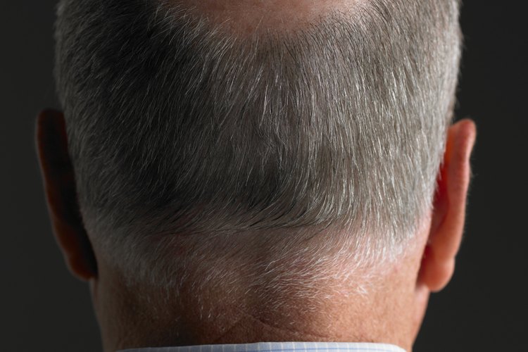 El crecimiento del pelo corto y fino es una señal muy alentadora.