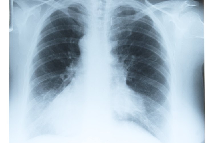 El bazo se ubica sobre el lado izquierdo del abdomen bajo las costillas.