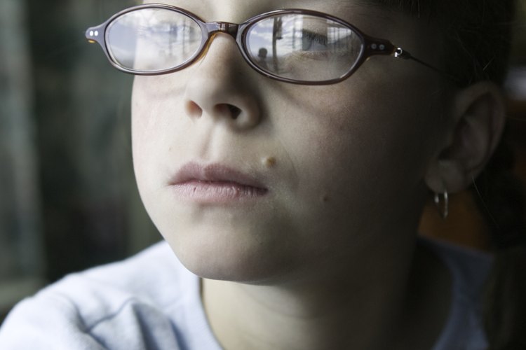 La mayoría de la manchas oscuras que aparece en la piel de un niño es benigna.