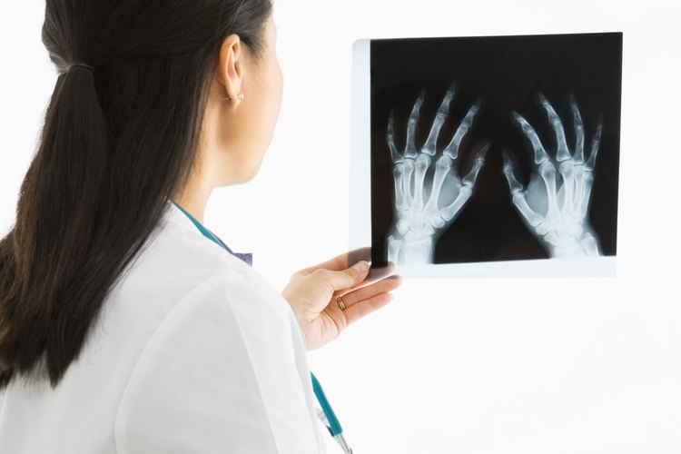 Los rayos x ayudan a diagnosticar el dolor de articulaciones.