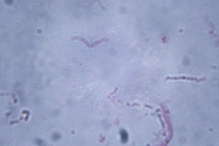 Muchas cepas de Enterococcus faecalis son resistentes a los antibióticos.