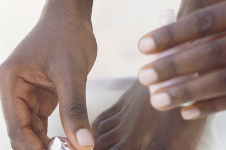 La onicomicosis, o simplemente los hongos en las uñas, es una infestación de hongos que puede decolorar las uñas de los pies y hacerlas quebradizas a punto de desmoronarse.