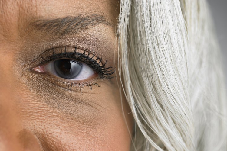 La fiebre del heno podría ser una causa de las ojeras.