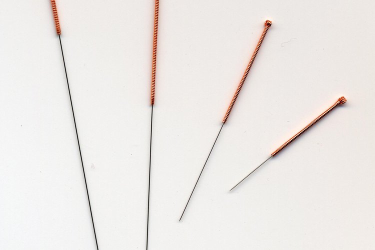 Los acupunturistas colocan ventosas.