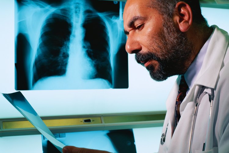 Los radiólogos con frecuencia encuentran anomalías leves en el pecho en las radiografías y tomografías computarizadas.