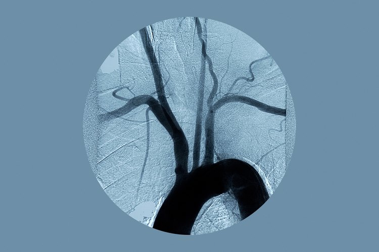 La arteria vertebral es una arteria principal del cuello que pasa a través de las vértebras cervicales.