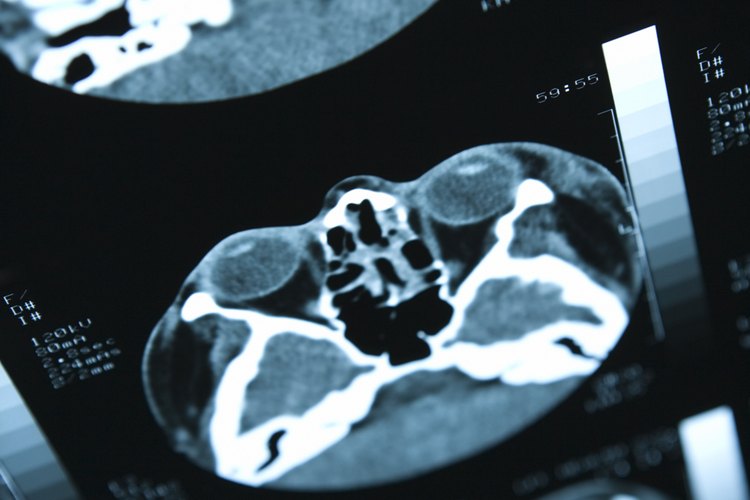 Las resonancias magnéticas son más costosas que las radiografías.