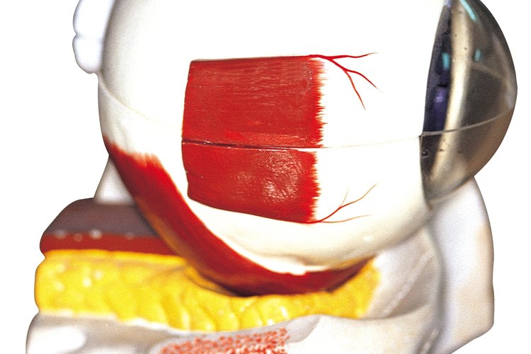 La retinopatía diabética se inicia con la inflamación de los vasos sanguíneos de la retina lo que lleva al crecimiento de nuevos vasos en una segunda etapa.