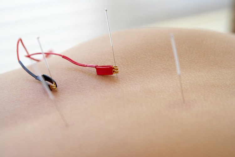 La terapia electrónica, también conocida como electroterapia, es una opción de tratamiento para los problemas de control del dolor.