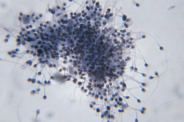 Hacer determinados cambios dietarios puede ayudar a aumentar el volumen de semen.