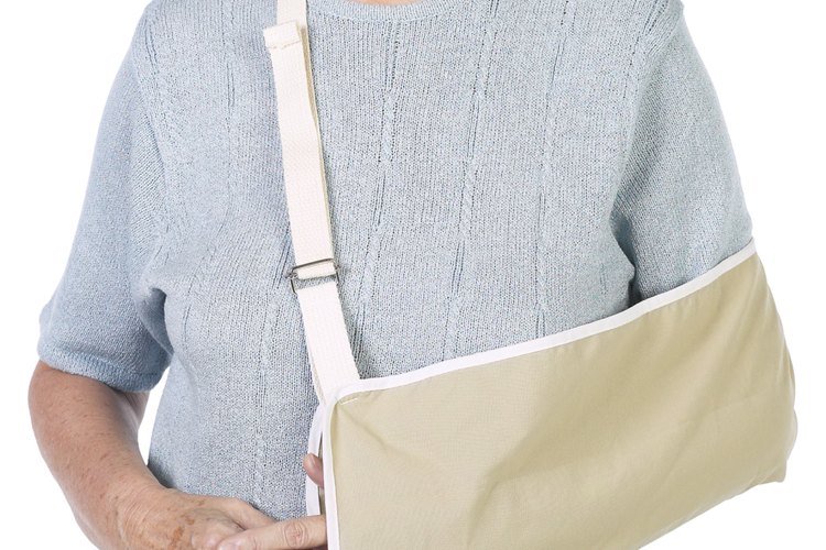 Las fracturas en los brazos se pueden inmovilizar con un cabestrillo.