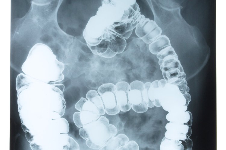 Cómo reducir el olor de los gases intestinales.