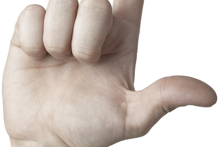 Un ligamento roto en la articulación de un dedo es una herida común.