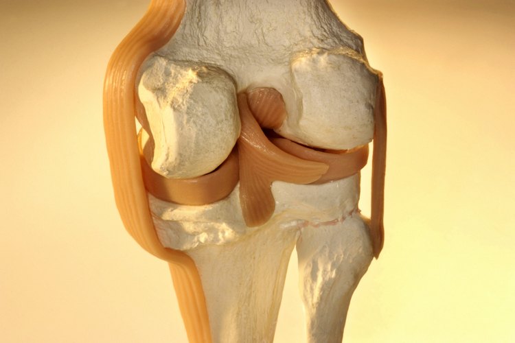 Las lesiones ACL son dolorosas, especialmente cuando tratas de hacer ejercicio.