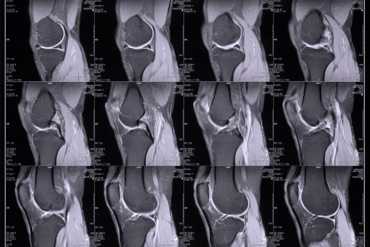 La página web TheraPilates recomienda que los pacientes con osteoporosis se escaneen la densidad ósea cada dos años.