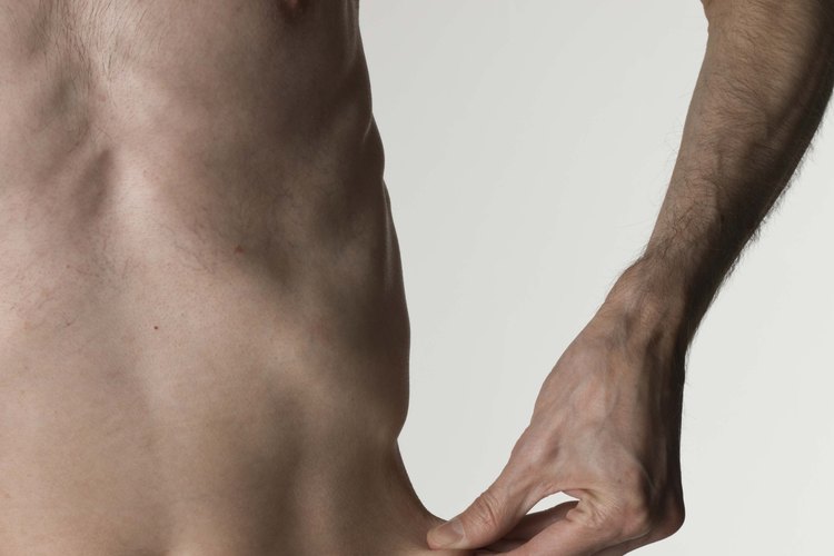La malnutrición es un signo severo de consumir muy pocas calorías.