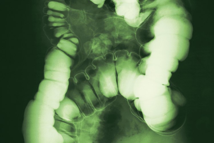Las vellosidades cubren tu intestino delgado.