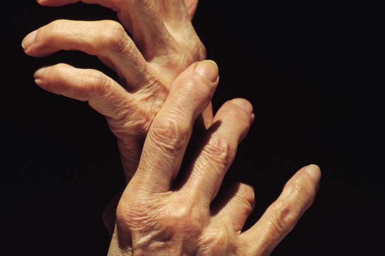 El dolor en las articulaciones puede ser causado por una deficiencia vitamínica.