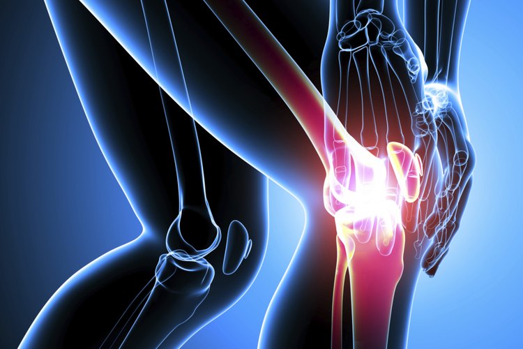 Dormir después de un reemplazo total de rodilla puede ser un desafío.
