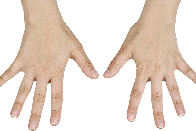 La parestesia causa una sensación de hormigueo en tus manos.