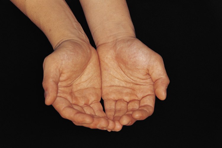 Según la Sociedad Internacional de Hiperhidrosis, esta enfermedad afecta a cerca del 3 por ciento de la población mundial.