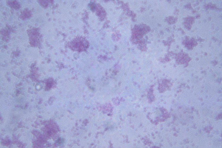 La E. coli es una de las bacterias que pueden encontrarse en una cocina.