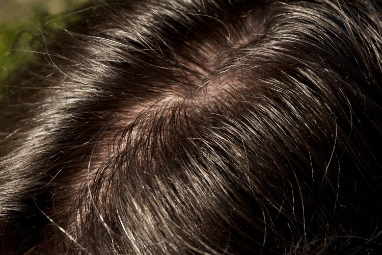Acercamiento a cabello de hombre brillante y grasoso.