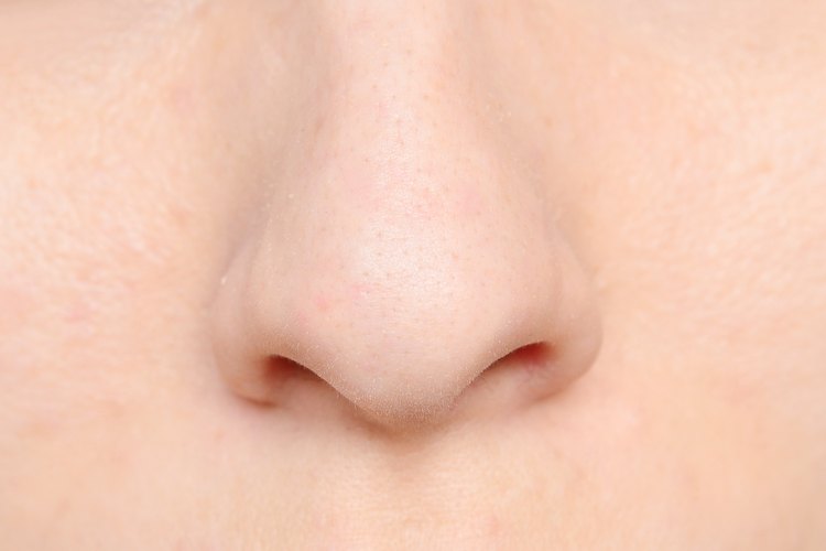 how-to-get-rid-of-veins-on-your-nose-leaftv