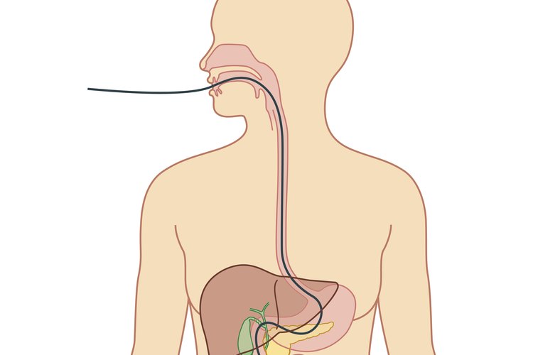 Ruta del Endoscopio