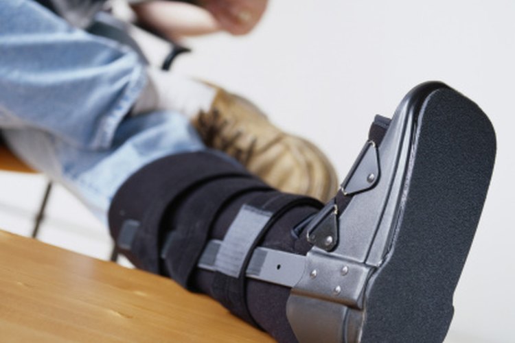 Puede que necesites usar una bota de caminar o yeso durante parte de tu rehabilitación.