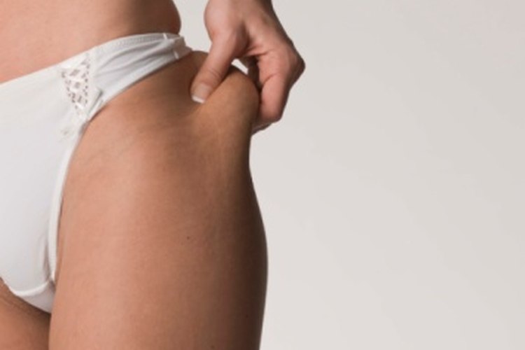 Una dieta controlada en calorías puede ayudar a perder grasa de la cadera y el muslo.