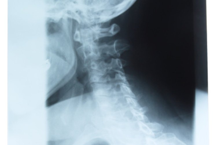 Mantener tu cuello sano puede mejorar tu funcionamiento diario mientras se reducen los niveles de dolor.