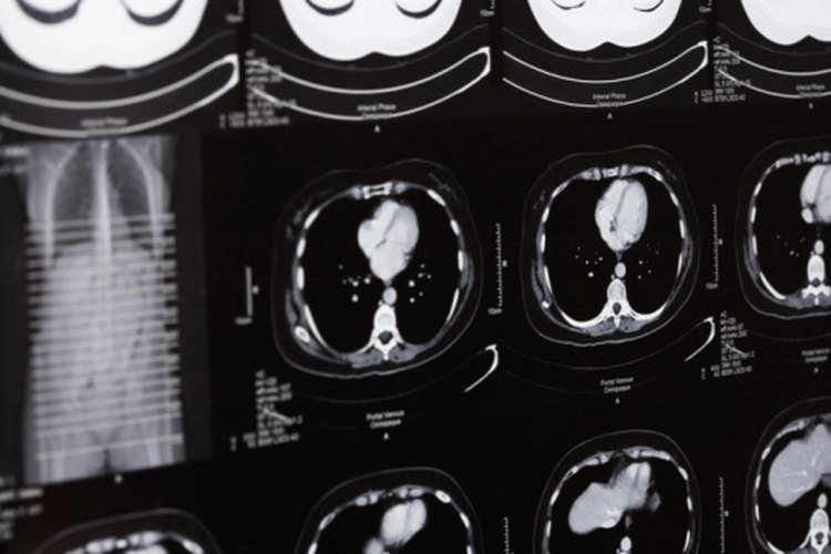 Los lóbulos frontales están al frente del cerebro y controlan la solución de problemas, movimientos y el habla.