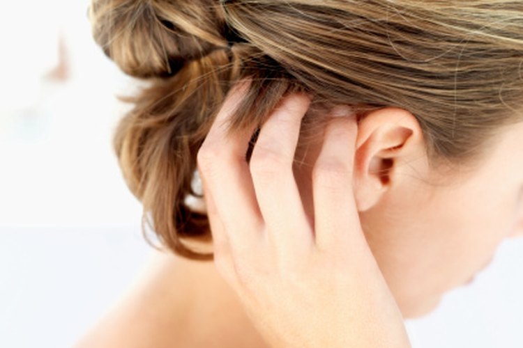 El herpes usualmente afecta el tronco pero ocasionalmente la cabeza.