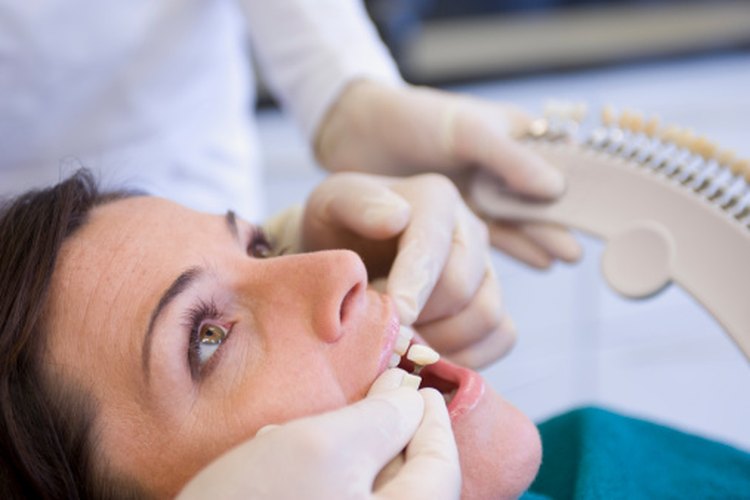 Diferentes cementos dentales ayudan a que las coronas se adhieran a los dientes.