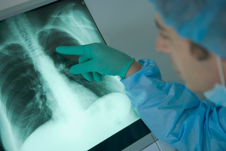 El asma afecta a varios órganos vitales, no sólo a los pulmones.