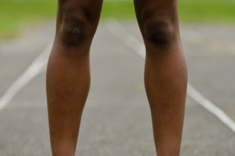 Las venas varicosas no deberían causar demasiado dolor en tus piernas mientras corres.