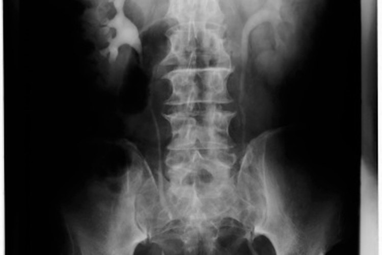 Los ejercicios para los músculos pélvicos ayudan a reducir la retención urinaria.