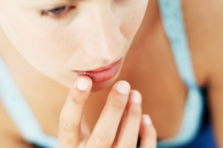 how-to-reduce-redness-after-picking-a-cold-sore-scab-leaftv