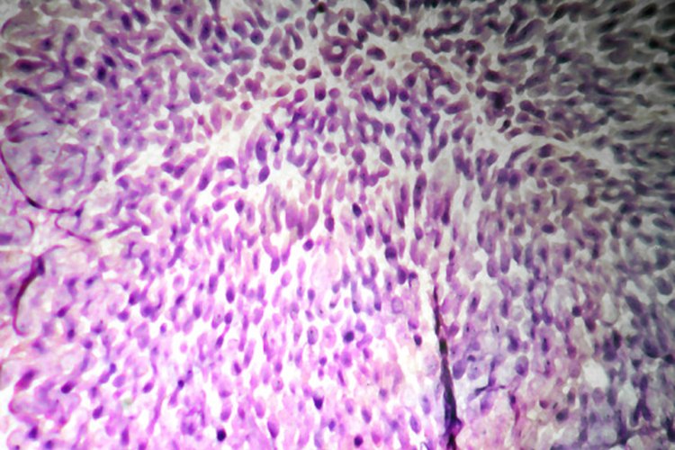 Las bacterias Gram negativas y Gram positivas responden de manera diferente al colorante de cristal violeta.
