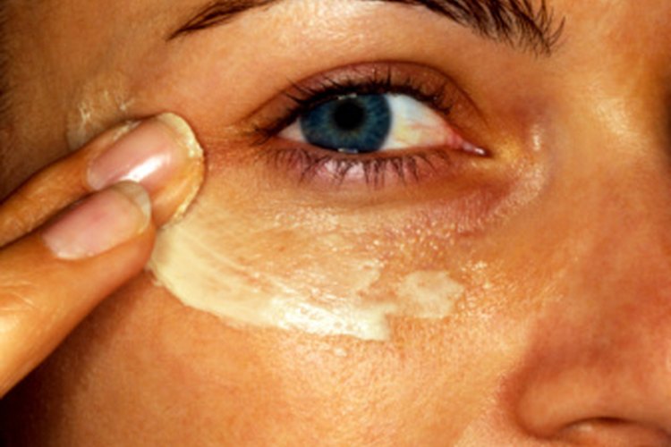Los retinoides tópicos pueden reducir las líneas finas debajo de los ojos.