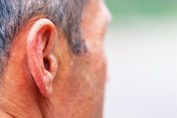 La hiperhidrosis facial ocasiona sudoración excesiva del rostro.