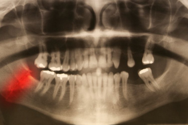 Los dientes y la mandíbula son un tipo de articulación.