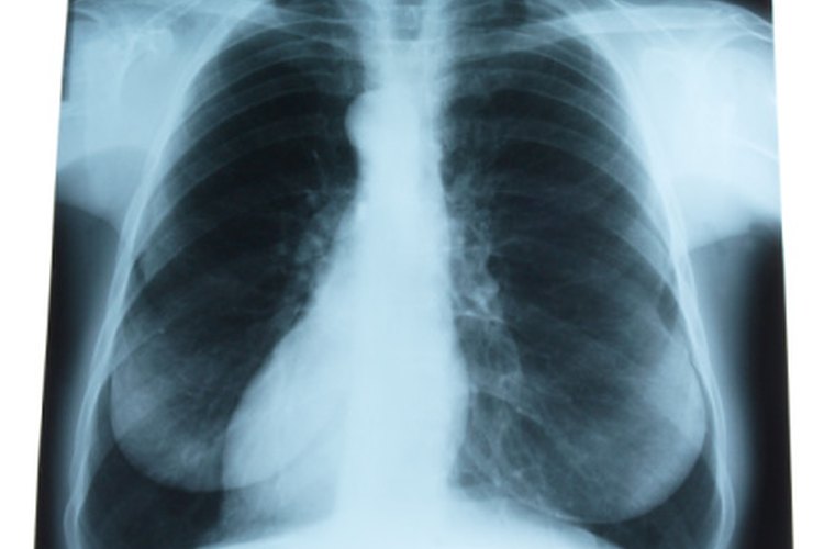 Regular la respiración.
