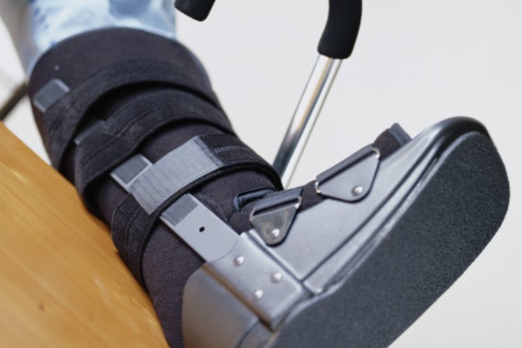 La recuperación de las fracturas suele requerir una rehabilitación física.