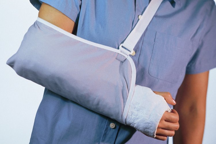 Los cabestrillos se utilizan para proteger un brazo lesionado.
